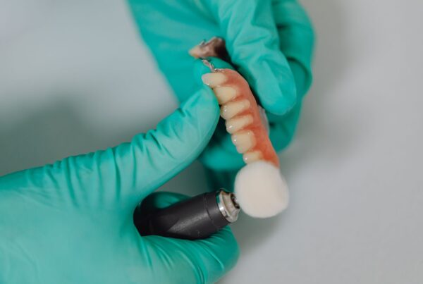 Châssis métallique de prothèse partielle amovible posé près d'un écran de conception numérique dans un laboratoire de prothèse dentaire