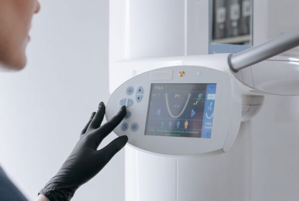 Base de prothèse amovible imprimée en 3D et châssis métallique posés sur un plan de travail de laboratoire dentaire